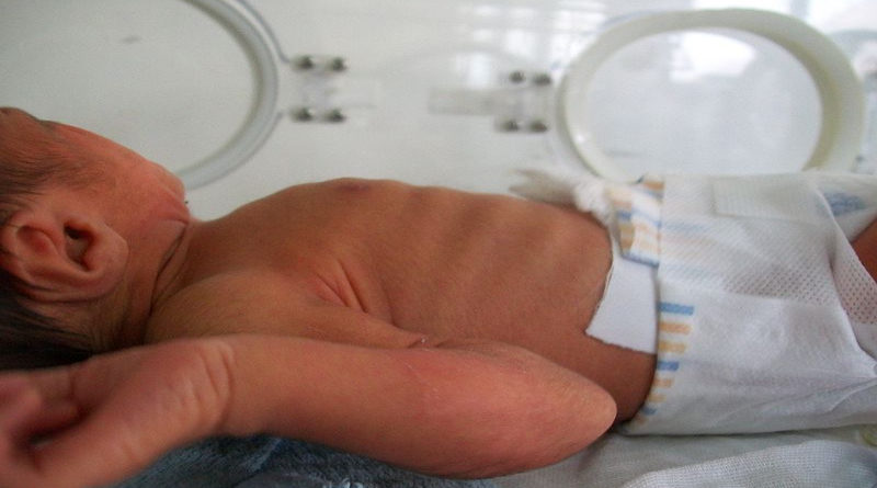 Nace un bebé con un pene de 20 cm y las enfermeras del hospital hacen cola para sacarle una foto